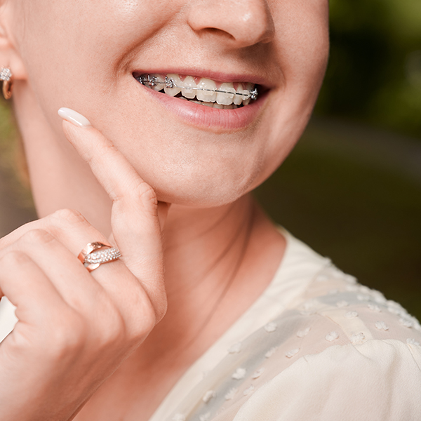 invisalign chapel hill