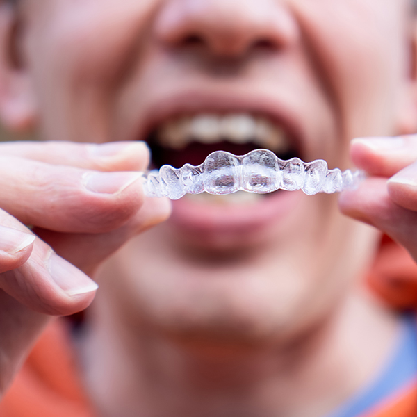 orthodontist chapel hill